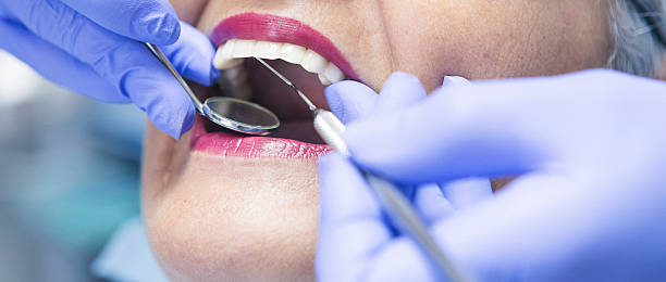 Best Knocked-Out Tooth Emergency  in Olney, TX